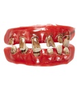 "DENTURE DE VIEILLARD"
